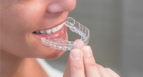 Apparecchi dentali trasparenti per adulti, quanto costano e perché sono utili